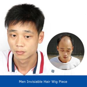 TSE Men's Short Straight Hair Wig: A Handsome Forehead Replacement