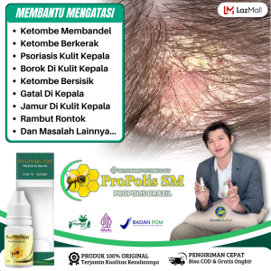 Obat Ketombe Membandel Ketombe Berkerak Koreng Di Kepala Kulit Kepala Bersisik Ketombe Kering Psoriasis KepalaEksim Kulit Kepala - Propolis SM Brazil Original