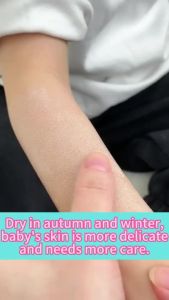 TinyBliss Kids Lotion 300ML Natural Rice Moisturizing Lotion Whitening Mild and Hypoallergenic