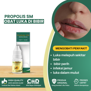 Obat Luka Di Bibir Obat Luka Di Mulut Obat Luka Melepuh Sekitar Bibir Obat Luka Di Langit Mulut Candidiasis Mulut Infeksi Jamur Di Dalam Mulut Sariawan Mulut Sariawan Lidah - Propolis SM