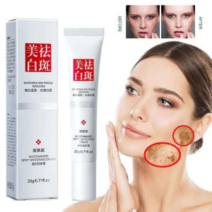 FUYAN WHITENING FRECKLE REMOVING CREAM/UNTUK FLEK HITAM