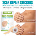 JKS（4*150cm）South Moon Silicone Scar Sheet High Efficiency Surgical Silicone Gel Tape Removal Scar Tape Treatment. 