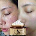 30g Whitening melasma cream Freckle Removing Cream pekas cream original japan  Remove Wrinkles Cream Pekas Remover Cream Blemish Cream Remove Melasma Freckles Anti Aging Serum Sunburn remove dark spot on face pikas remover cream Moisturizing Cream. 