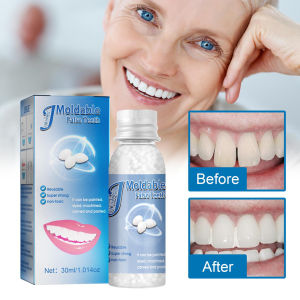30ml Teeth Glue Fix Broken Gaps Temporary Tooth DIY Tooth Filling Solid Denture Material Tooth Repair Granules False Teeth