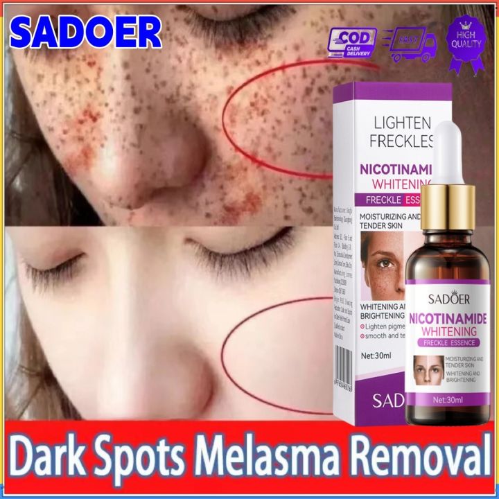 SAODER Whitening Essence Serum Remove Whiten Facial Moisturize Serum Remove Freckle Fade Dark Spot Anti-aging Whiten Facial Moisturize Serum Wajah Glowing Whitening Essence Niacinamide Skin Serum pencuci flek Removing Dark spot