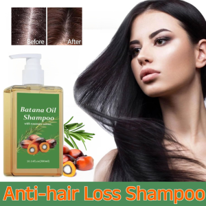 Anti-hair Loss Shampoo Hair Growth Shampoo Anti-itching Oil Control Repair Treatment Regrowth Hair Thick