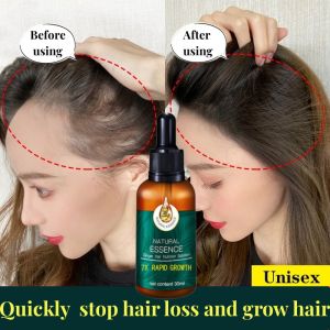 Hair Growth Serum Ginger Hair Treatment hair 7X Rapid Growth for Thicker Healthier Hair