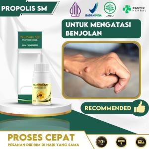 Obat Benjolan Lipoma Obat Benjolan Seluruh Area Dengan Propolis SM