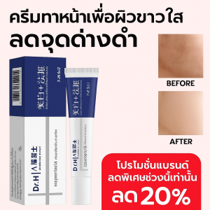 ดร.เซียวลี่ ครีมลบกระไวท์เทนนิ่ง ครีมไวท์เทนนิ่งและป้องกันฝ้ากระ
