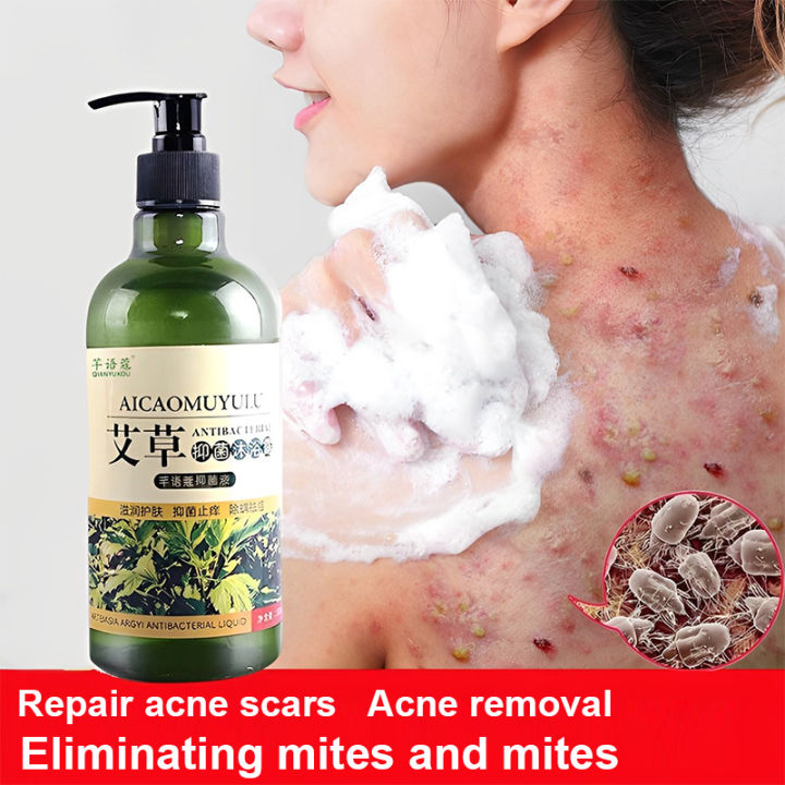 Acne body wash Antimite Shower Gel Antibacterial and Removal of mites