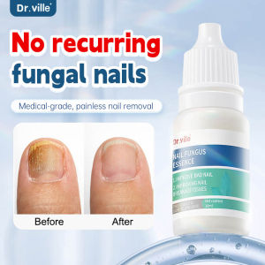 Japan Anti Fungal Spray Skin Care Nail Fungus Treatment Original Stop Fungal Growth Nail Care 5ml