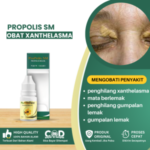 Obat Xanthelasma Obat Penghilang Xanthelasma Obat Mata Berlemak Penghilang Gumpalan Lemak Pada Kelopak Mata Penghilang Plak Mata Kuning Di Kelopak Mata Obat Oles Lemak Di Kelopak Mata Gumpalan Lemak - Propolis SM