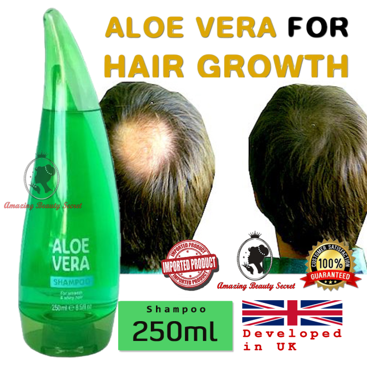 100% Authentic Xpel XBC Aloe Vera shampoo Hair growth (Developed in UK)  250Ml Hair Care Shampoo Soothe Nourish Scalp Shampoo Hair Loss Damage  Dandruff Shampoo - Lazada | Lazada PH