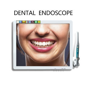 Dental Endoscope All-in-one Oral Hd Camera Oral Instrument Material Dentist Teeth Tool