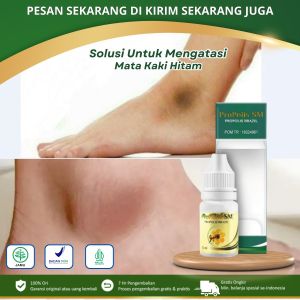 PROPOLIS SM - Obat Pemutih Mata Kaki Hitam Obat Oles Mata Kaki Hitam Mata Kaki Kering Mata Kaki Luka Lecet Melembabkan Kaki Yang Kering Mengatasi Kaki Pecah-Pecah