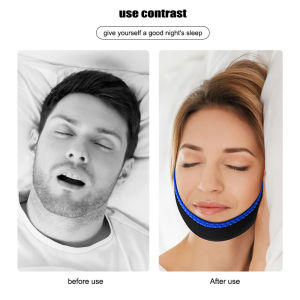 [Childhood MS] Anti Snore Chin Strap Nylon Elastic Breathable anti-Snoring Chin Belt Mouth Breathing Band Apnea Belt Improve Sleeping Care Tool