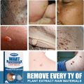 Plester Kutil Mata Ikan untuk Kaki Kapalan Foot Corn Removal Plaster Koyo Penghilang Mata Ikan12pcs plester mata ikan,obat mata ikan di telapak kaki,plaster mata ikan. 