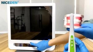 Intraoral Camera Dental Equipment 16MP HD Oral Endoscope 17 Inch LCD Monitor Wireless WiFi Real Time Transmission