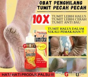 Tumitku Callus remover lotion free alat penghalus kaki DZ