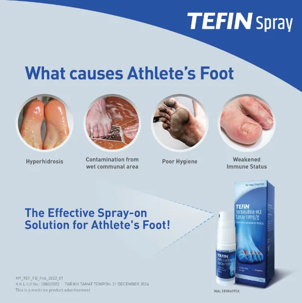 2 X Tefin Terbinafine HCI Spray Traitement Fongique 10 Mg/g 15 Ml - Neuf