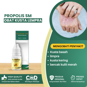 Obat Penyakit Kusta Kering Basah Obat Lempra Infeksi Kronis Obat Kusta Lepra Kering Obat Kusta Basah Lesi Kulit Panu Bercak Obat Bercak Kulit Hitam Merah Obat Kusta Untuk Semua Umur Infeksi Jamur Kulit Mati Rasa - Propolis sm