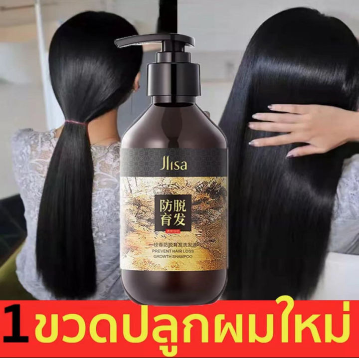 ZHENXIU 300ml แชมพูแก้ผมร่วง แชมพูขิง แชมพูสำหรับผมขาดหลุดร่วง ป้องกัน