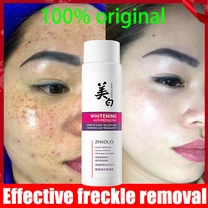 【3 Days Effective】Effective Whitening Freckle Cream Original ...