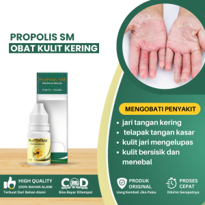 Obat Jari Tangan Kering Obat Telapak Tangan Kasar Obat Jari Pecah Pecah Obat Kulit Jari Mengelupas Kulit Jari Bersisik Dan Menebal Obat Jari Tangan Mengelupas Obat Ruam Perih Di Kulit - Propolis SM