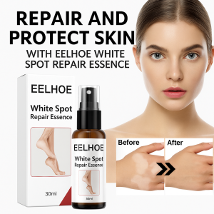 Vitiligo Repair Spray White Spot Repair Essence Spray Vitiligo Repair Spray Sweat Spot And White Spot Care Solution