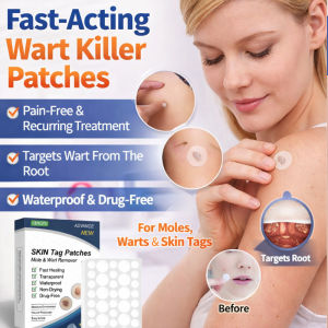 Acne Patch Wart Patch Invisible Hydrocolloid Fast Removal Clear Skin Treatment Skin Care Remover Patch