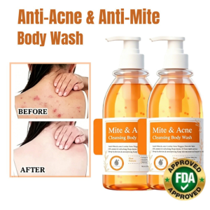 Mite Acne Cleansing Body Wash France Imported Gentle Foaming Soft Cleanse Fights Inflammation Soothes Redness Plant Miticide Eliminates Bacteria Growth Sodium Salicylate Softens Rough Skin Unclogs Pores Zinc PCA Controls Oil Minimizes Shine Shower Gel