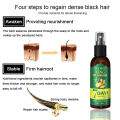 Eelhoe 7 Day Ginger Germinal Serum Essence Oil Hair Loss Treatment Effective Fast Growth Hair Care Ginger Hair Loss Treatment Fast Hair Regrowth Essential Oil 7 Days Anti-loss Strong the Root of Hair Serum. 