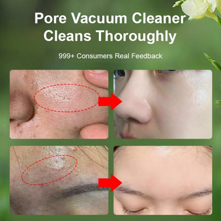 Bubble%20Cleansing%20Mask%20Foaming%20Bubble%20Mask%20Deep%20Cleansing%20Blackhead%20Mask%20Oil%20Control%20Moisturizing%20Shrink%20Pore%20-%20Image%204