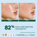 NPURE NPURE SUNSCREEN CICA BEAT THE SUN MATTE SPF 50+ PA++++/ SUNSCREEN JERAWAT / SUNSCREEN HYPOALLERGENIC Acid Extract Beruntusan Hydrating Mencerahkan Wajah. 