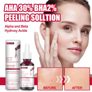 Eelhoe Axit Trái Cây Axit Salicylic Chất AHA 30% + BHA 2% Loại Bỏ Sẹo Mụn Đóng Off Huyết Thanh Thu Nhỏ Lỗ Chân Lông Làm Trắng Da Tẩy Tế Bào Chết Vẻ Đẹp Kem Dưỡng Ẩm Chống Lão Hóa Tinh Chất Dưỡng Da Mặt Chăm Sóc (30Ml)