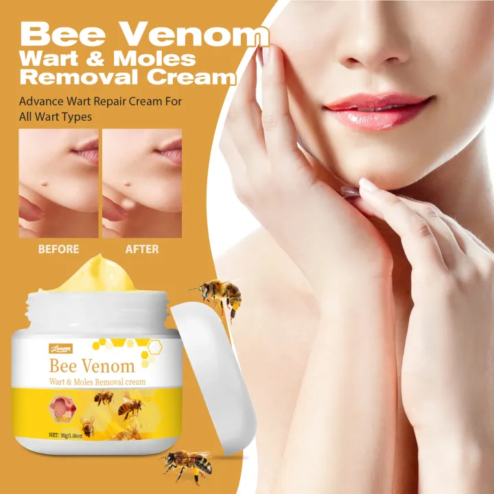 Bee Venom Removal Cream, Bee Venom Treatment Cream, New Professional