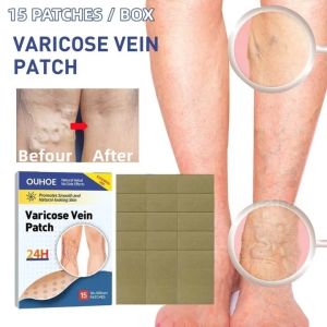 Miếng Dán Giãn Tĩnh Mạch Chân Cao Cấp - Hỗ Trợ Lưu Thông Máu Giảm Nặng Chân & Chuột Rút