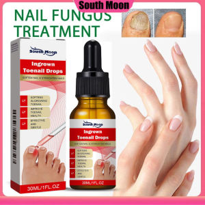 Serum Nấm Móng Phục Hồi Móng Thối Móng Hư Nấm Móng Giúp Đẹp Móng Từ Thảo Dược