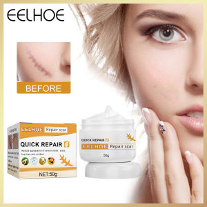 Eelhoe Quick Repair Scar Cream Scar Cream For Face Body Scar Cream For Old Scar Acne Scar Stretch Marks Skin Care Pigmentation Corrector Anti-allergic Calm Whitening Face Cream Scar Repair Cream Acne Spots Acne Treatment(50g)