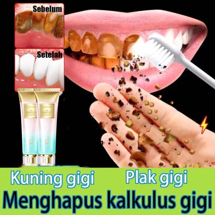 Gigi Petir Kecantikan Alami