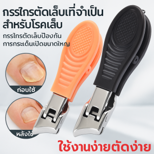 จำเป็นสำหรับการรักษา กรรไกรตัดเล็บขบ กรรไกรตัดเล็บแบบเอียง ขนาดใหญ่ สแตนเลส 指甲刀