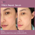 111SKIN - REPAIR SERUM NAC Y2 30 ML. 111สกิน รีแพร์เซรั่ม แน็ค วาย2 30มล.. 