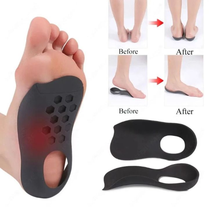 YSCALE Soft Flat Foot OShaped Legs Insole TPE Comfortable Foot Care