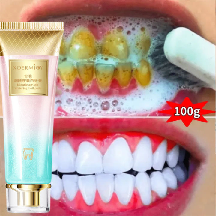 Pasta gigi pemutih Penghilang karang gigi Odol pemutih gigi dan karang