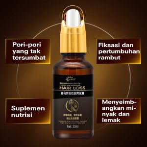 【HOT🔥】Penumbuh rambut botak Serum penumbuh rambut 30ml Penumbuh rambut cepat Kontrol minyak Menyuburkan rambut Mencegah Kebotakan