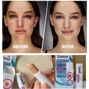 Thỏi che khuyết điểm BALEA HAUTTREIN nội địa Đức