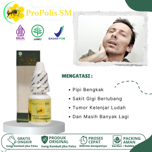 Obat Pipi Bengkak Akibat Sakit Gigi Pengempes Pipi Bengkak Pipi Terasa Sakit Pipi Bengkak Sebelah Perikoronitis Sialolithiasis Syok Anafilaktik Tumor Kelenjar Pada Ludah Anak dan Dewasa Dengan ProPolis SM