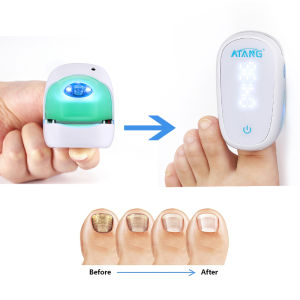 Cold Laser Therapy Toenail Fungus for Fingernail Infection Onychom Laser Treatmentf Emuaidmax for Nail Fungus