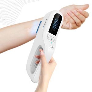 Kernel KN-5000F home use high power 308 nm Excimer lamp for vitiligo psoriasist targeted treatment