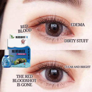 Eye Drops for CATARAL EYE WASH DRY EYES DROPS CLEANER | ItCHy Eyes | Glaucoma | Bloodshot | Sore Eyes Mo Infection Eye Washing fluid eye drops from japan